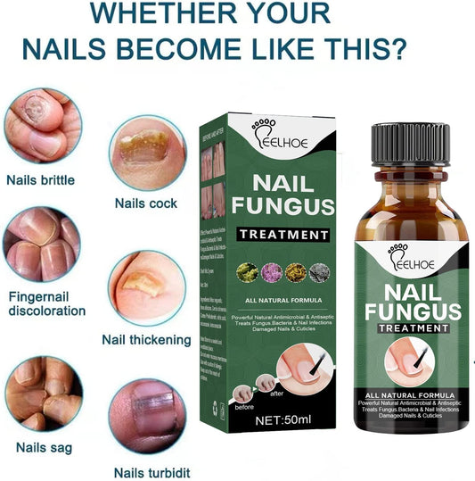 Fungal Nail Treatment,Antifungal Nail Repair,Antifungal Nail Treatment