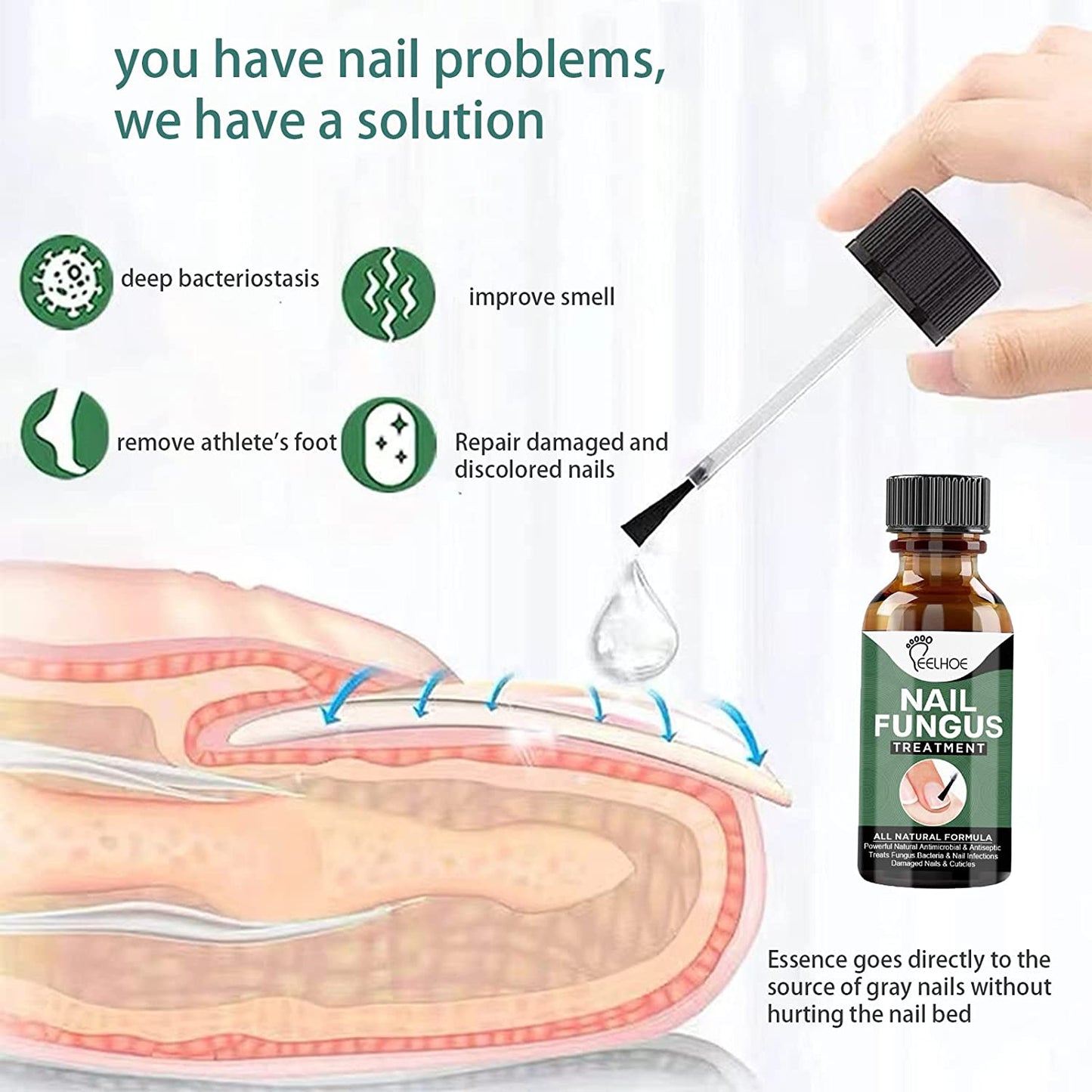 Fungal Nail Treatment,Antifungal Nail Repair,Antifungal Nail Treatment