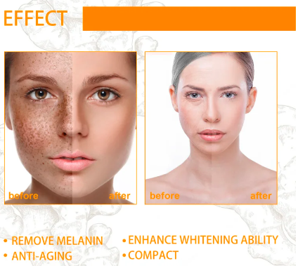 Turmeric Whitening Freckles Serum Remove Melasma Dark Spot